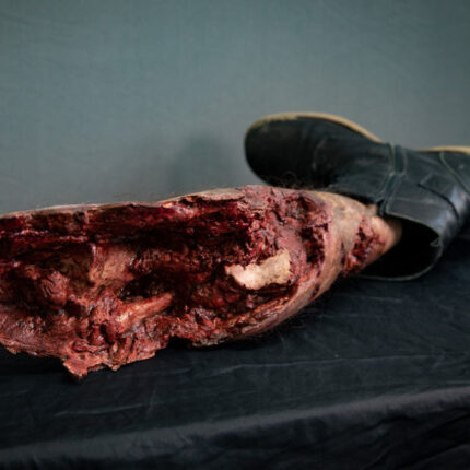 Severed Leg