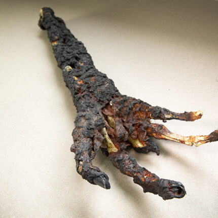 Burned Hand