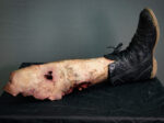 Severed Leg