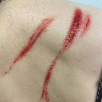 Whip Marks 1