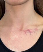 Big Vessels Veins 03