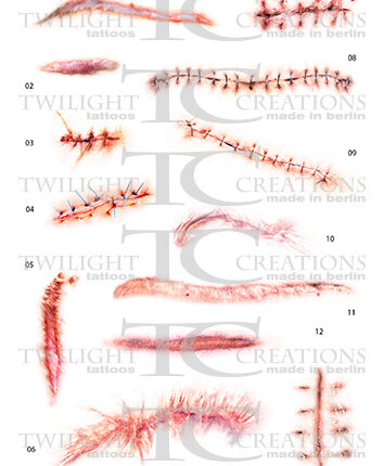 Scars and Sutures A
