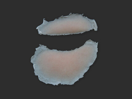 SB4 Geschwollenes Auge (rechts)