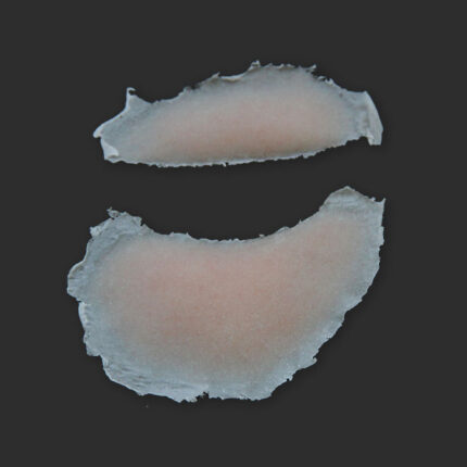 SB4 Geschwollenes Auge (rechts)