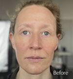 Old Age Prosthetics [Subtil] - Gesicht