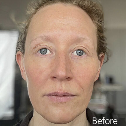 Old Age Prosthetics [Subtil] - Gesicht