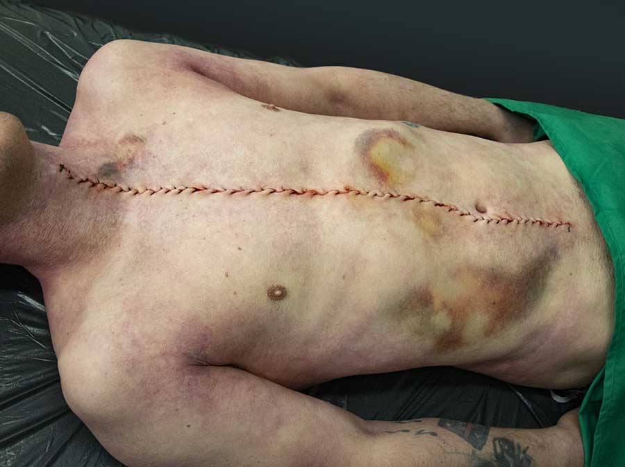 SF9 Naht (große Form)