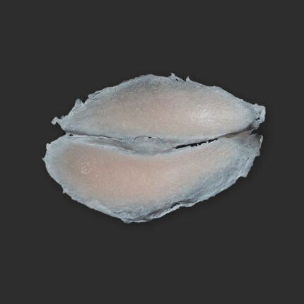 SB5 Geschwollenes Auge (rechts)