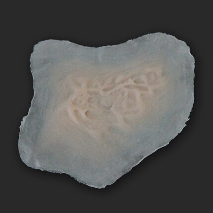 S5 Narbe