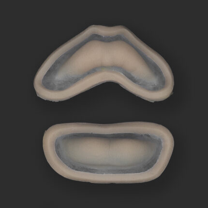 Filled Lips