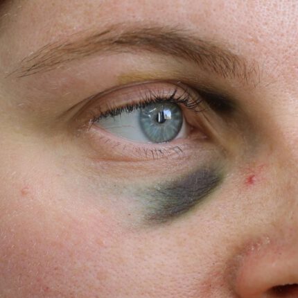 Black Eyes Set