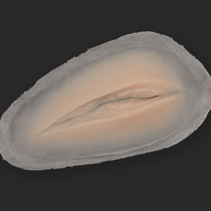 C18 Schnittwunde