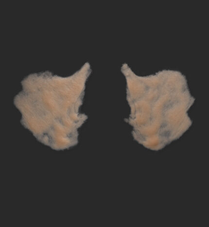 Old Age Prosthetics [Subtil] - Wangen