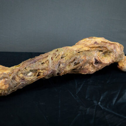 Rotten Leg