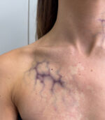 Big Vessels Veins 02