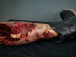 Severed Leg