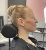 Old Age Prosthetics [Subtil] - Hals