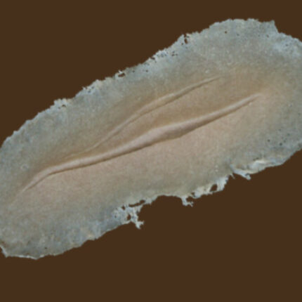 C8 Schnittwunde