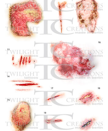 Random Wounds 2