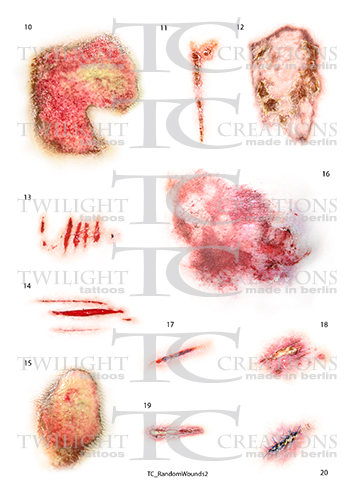 Random Wounds 2
