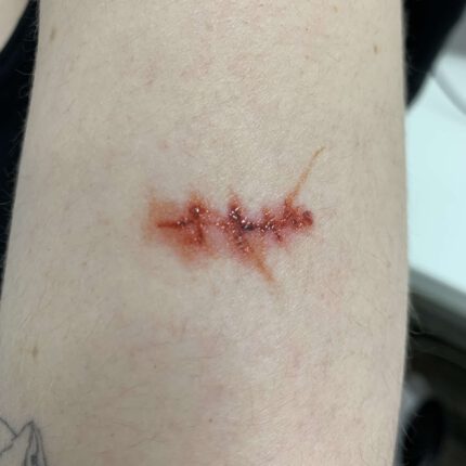 Scars and Sutures B