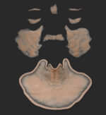 Old Age Prosthetics [Subtil] - Komplettes Set