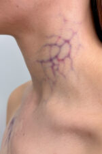 Big Vessels Veins 02