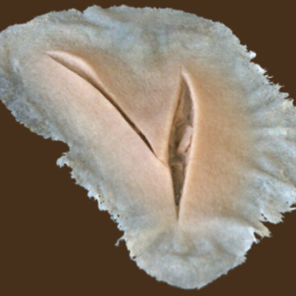 C5 Schnittwunde
