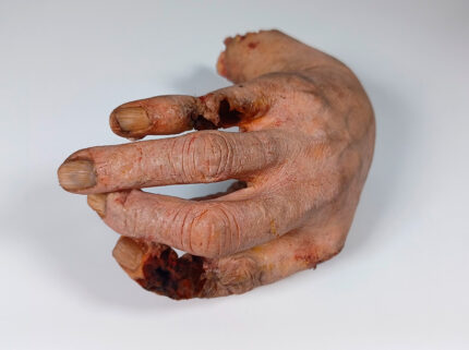 Walda - Infizierte rechte Hand BACKGROUND