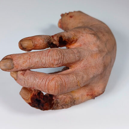Walda - Infizierte rechte Hand BACKGROUND