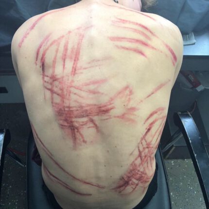 Whip Marks 2