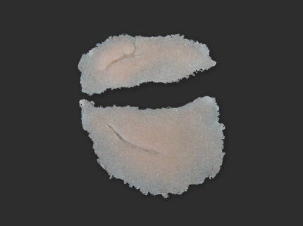 SB3 Geschwollenes Auge (links)