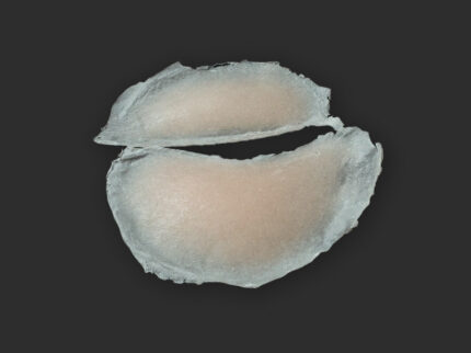 SB7 Geschwollenes Auge (rechts)