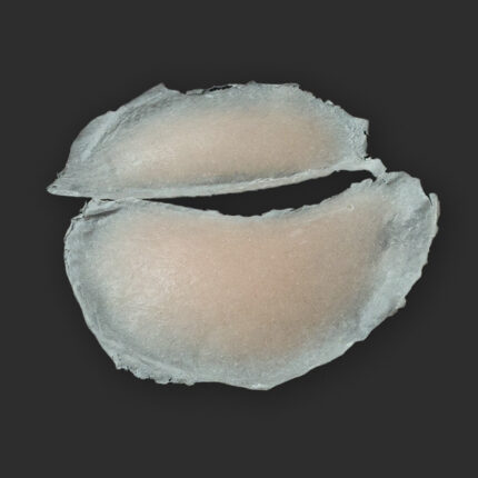 SB7 Geschwollenes Auge (rechts)