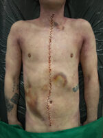 SF9 Naht (große Form)