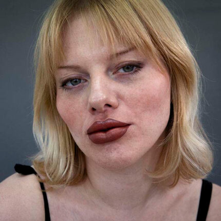 Filler Set - Lips & Cheeks