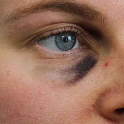 Black Eyes Set